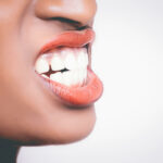 Silna nadwrażliwość zębów
