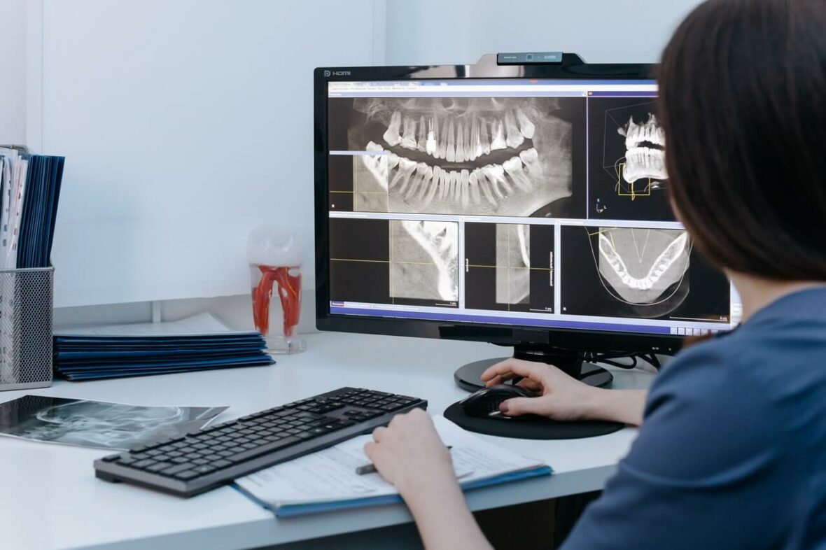 Jak często można robić tomografię zębów?