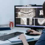 Jak często można robić tomografię zębów?